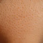Come capire se la pelle è secca o grassa: le caratteristiche che non ingannano