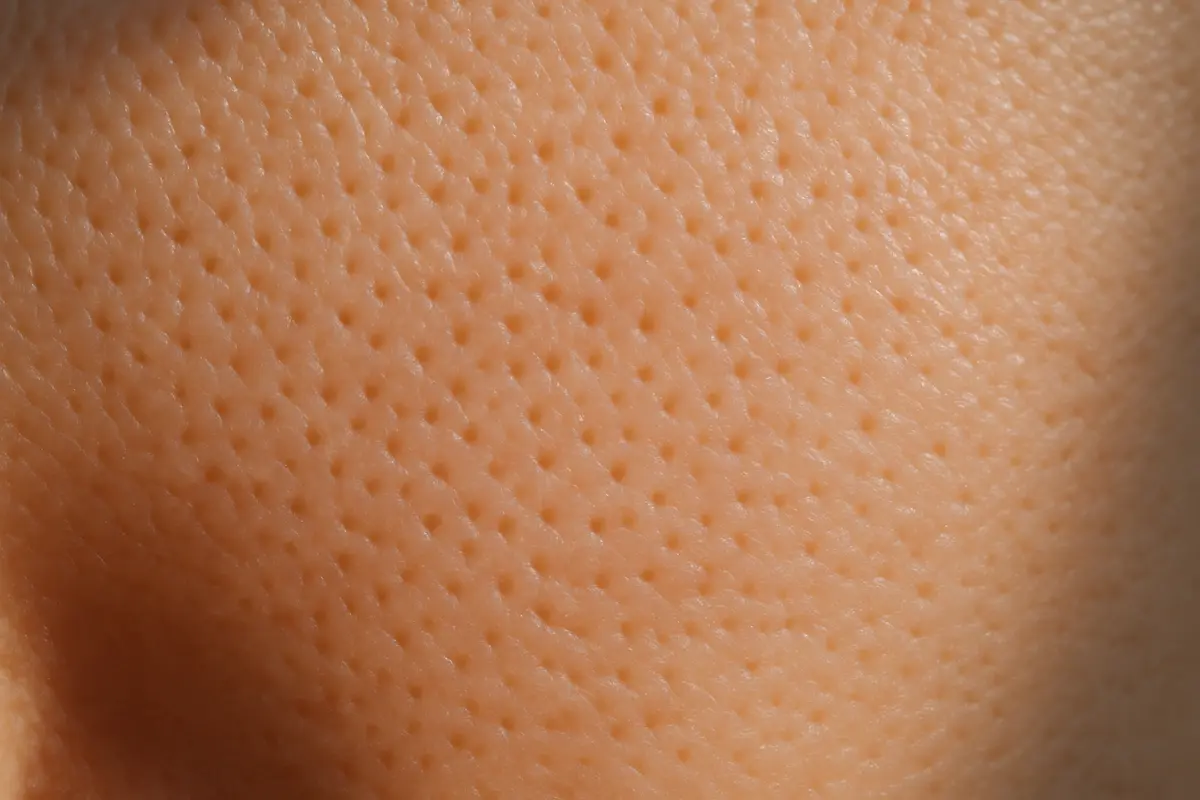 Come capire se la pelle è secca o grassa: le caratteristiche che non ingannano